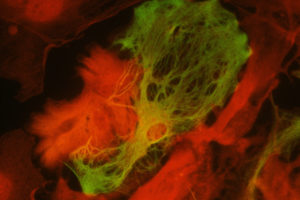Cell-picture-300x200 Cell-picture-300x200